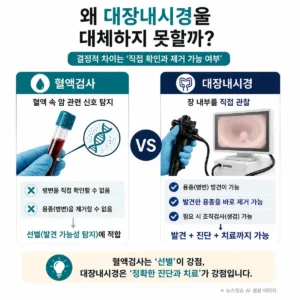 대장암 혈액검사와 대장내시경의 차이 및 용종 제거 가능 여부